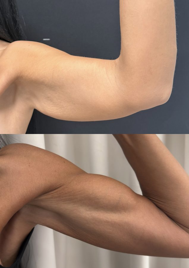 ResResultado en 2 meses después de 6 sesionesultado en 2 meses después de 6 sesiones